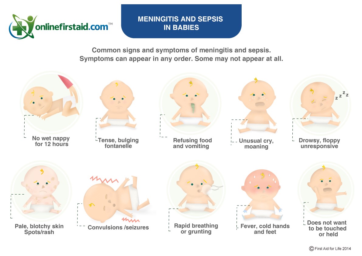 sepsis-life-threatening-yet-difficult-to-spot-talkhealth